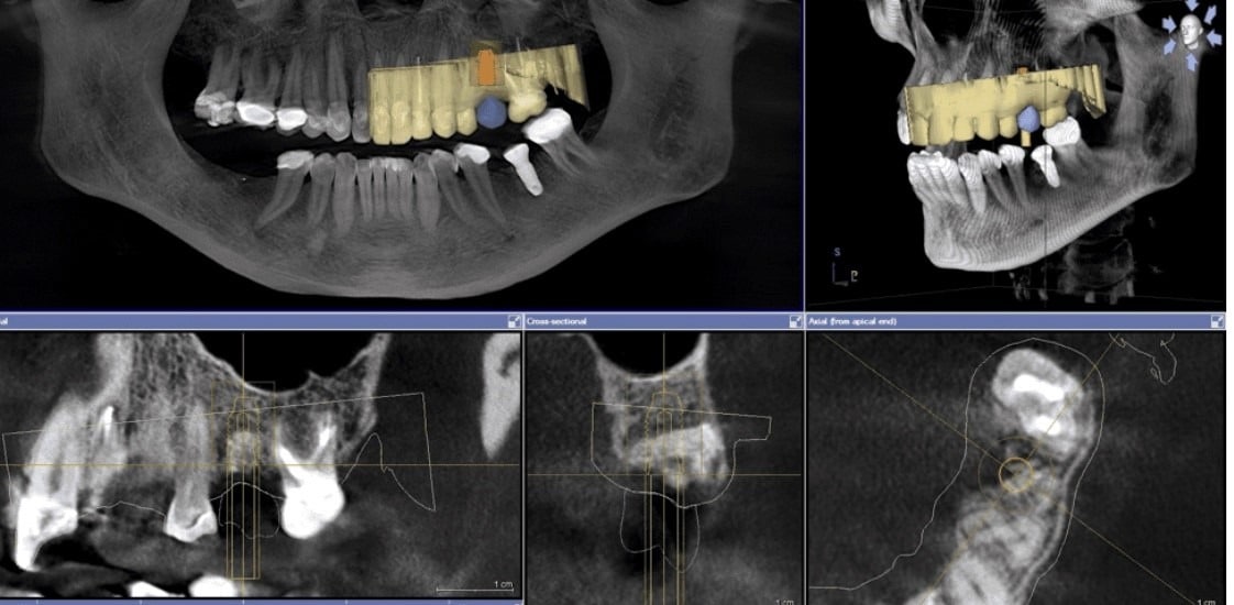 cbct-imaging-beyond-dental-x-rays-its-dental-hospital